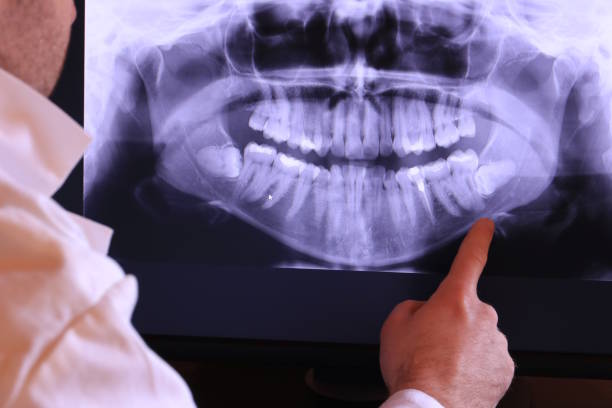Best Dentist for Tooth Abscess  in Wolcottville, IN